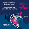 SMARTGUARD ANTI-SNORE DEVICE